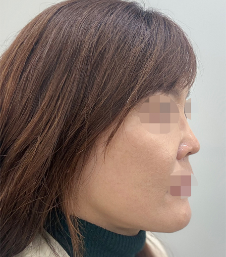 a32f9a99a88dba41b61a805ff0dcae9b_1733987555_2747.jpg
