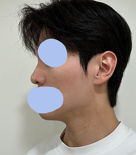 73daac9767c87081e25aac818b1c8bc1_1750146507_527.jpg 73daac9767c87081e25aac818b1c8bc1_1750146507_527.jpg