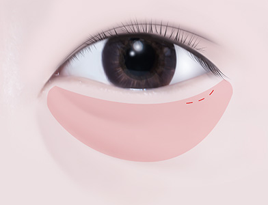 02. 안륜근 보존